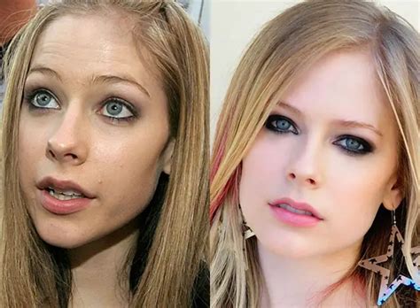 avril lavigne boobs|Avril Lavigne Before and After Plastic Surgery: Nose, Face, Boobs